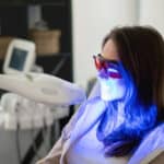 Teeth whitening