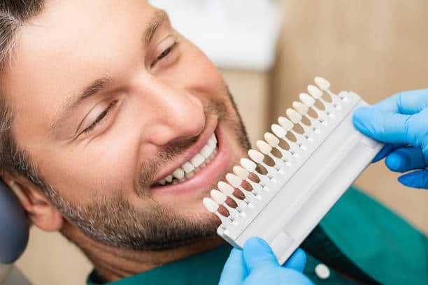 Dental Veneer