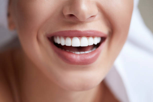 Healthy white smile close up. Beauty woman with perfect smile, lips and teeth. Beautiful Model Girl with perfect skin.